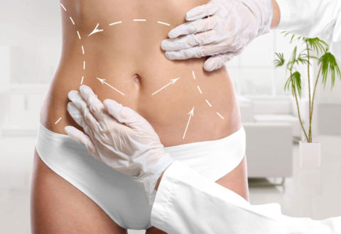 Liposuction istanbul